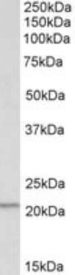 Western Blot: LMP2/PSMB9 Antibody [NBP1-52090]