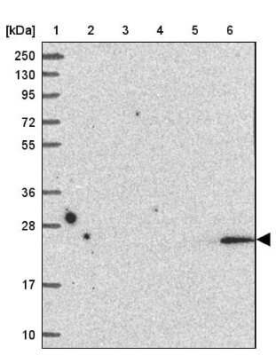 Western Blot: LMP2/PSMB9 Antibody [NBP2-33681]