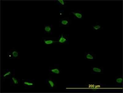 Immunocytochemistry/ Immunofluorescence: LMP7/PSMB8 Antibody (1B3) [H00005696-M01]