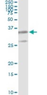Immunoprecipitation: LMP7/PSMB8 Antibody (1B3) [H00005696-M01]