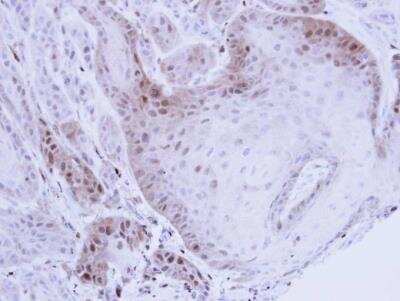 Immunohistochemistry-Paraffin: LMP7/PSMB8 Antibody [NBP1-33540]