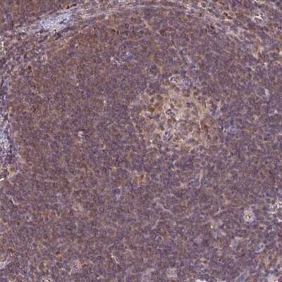 Immunohistochemistry-Paraffin: LMP7/PSMB8 Antibody [NBP2-47395]