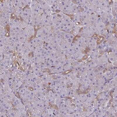 Immunohistochemistry-Paraffin: LMP7/PSMB8 Antibody [NBP2-47395]