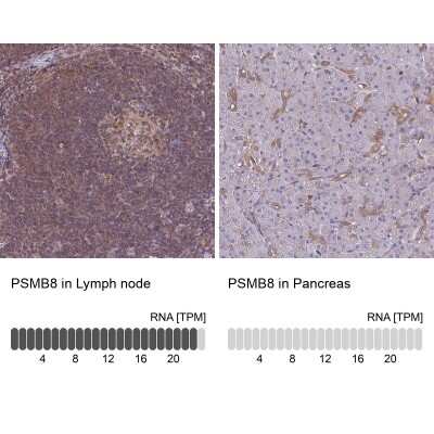 Immunohistochemistry-Paraffin: LMP7/PSMB8 Antibody [NBP2-47395]