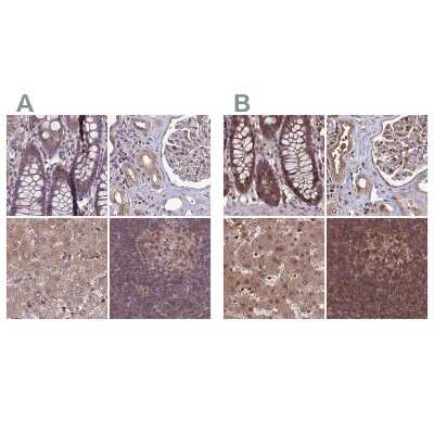 Immunohistochemistry-Paraffin: LMP7/PSMB8 Antibody [NBP2-47395]