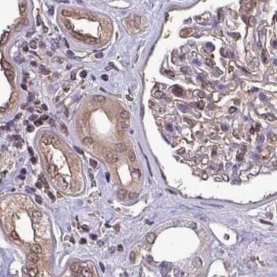 Immunohistochemistry-Paraffin: LMP7/PSMB8 Antibody [NBP2-47395]