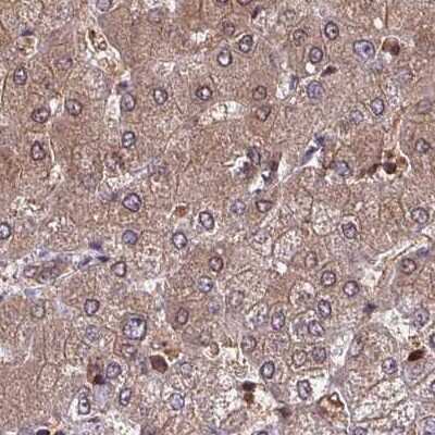 Immunohistochemistry-Paraffin: LMP7/PSMB8 Antibody [NBP2-47395]
