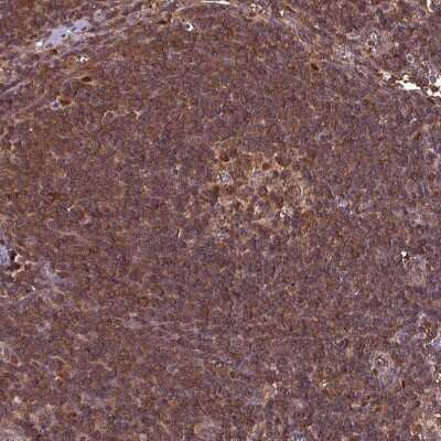 Immunohistochemistry-Paraffin: LMP7/PSMB8 Antibody [NBP2-47396]