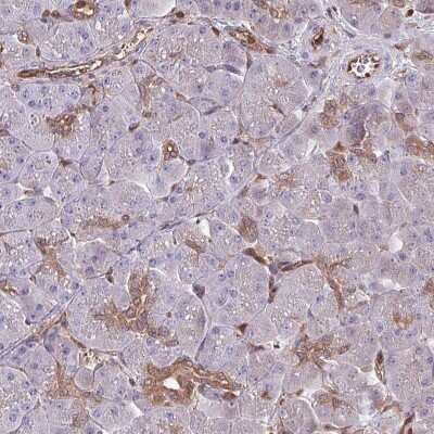 Immunohistochemistry-Paraffin: LMP7/PSMB8 Antibody [NBP2-47396]