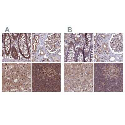 Immunohistochemistry-Paraffin: LMP7/PSMB8 Antibody [NBP2-47396]