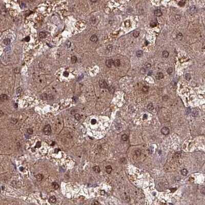 Immunohistochemistry-Paraffin: LMP7/PSMB8 Antibody [NBP2-47396]