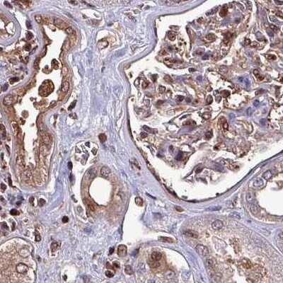 Immunohistochemistry-Paraffin: LMP7/PSMB8 Antibody [NBP2-47396]