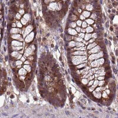 Immunohistochemistry-Paraffin: LMP7/PSMB8 Antibody [NBP2-47396]