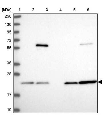Western Blot: LMP7/PSMB8 Antibody [NBP2-47396]