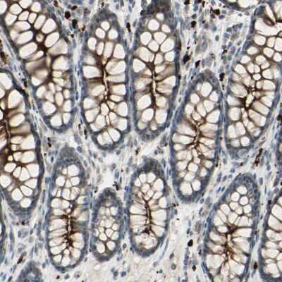 Immunohistochemistry-Paraffin: LMTK2 Antibody [NBP1-89320]