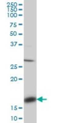 Western Blot: LMW-PTP/ACP1 Antibody (4B10) [H00000052-M01]