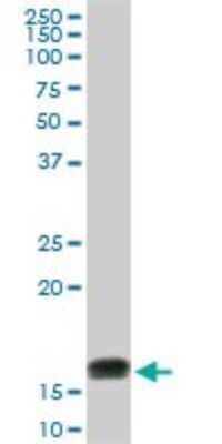 Western Blot: LMW-PTP/ACP1 Antibody (4B10) [H00000052-M01]