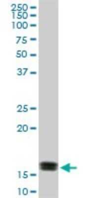 Western Blot: LMW-PTP/ACP1 Antibody (4B10) [H00000052-M01]