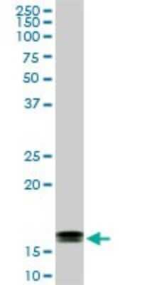 Western Blot: LMW-PTP/ACP1 Antibody (4B10) [H00000052-M01]
