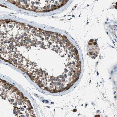 Immunohistochemistry-Paraffin: LMW-PTP/ACP1 Antibody [NBP1-89551]