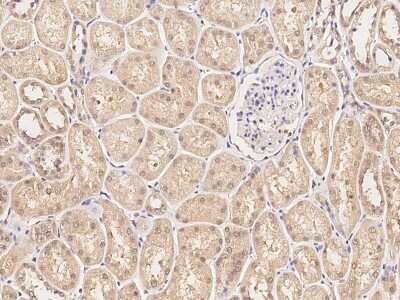 Immunohistochemistry-Paraffin: LMW-PTP/ACP1 Antibody [NBP2-99671]