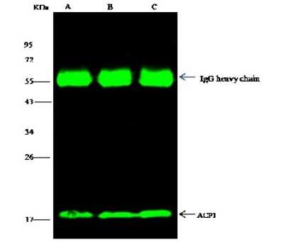 Immunoprecipitation: LMW-PTP/ACP1 Antibody [NBP2-99671]