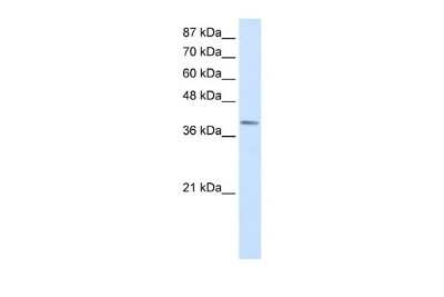 Western Blot: LMX1A Antibody [NBP2-84141]