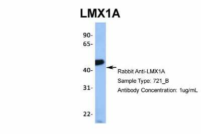 Western Blot: LMX1A Antibody [NBP2-84141]