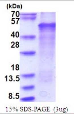SDS-PAGE: Recombinant Human LMX1b His Protein [NBP2-51742]