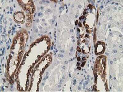 Immunohistochemistry-Paraffin: LNK/SH2B3 Antibody (OTI2D8) [NBP2-00641]