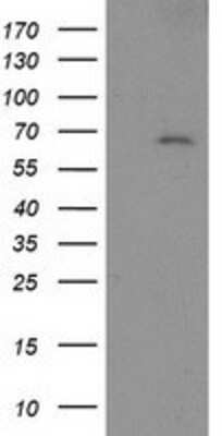 Western Blot: LNK/SH2B3 Antibody (OTI2D8) [NBP2-00641]