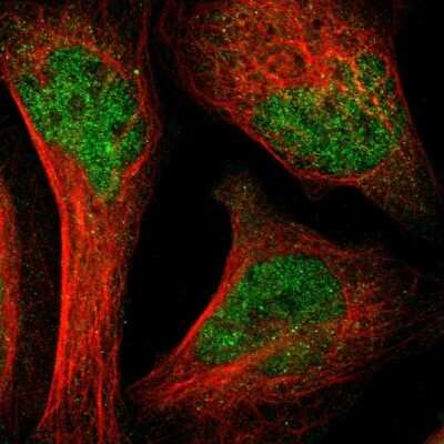Immunocytochemistry/ Immunofluorescence: LNK/SH2B3 Antibody [NBP1-87867]
