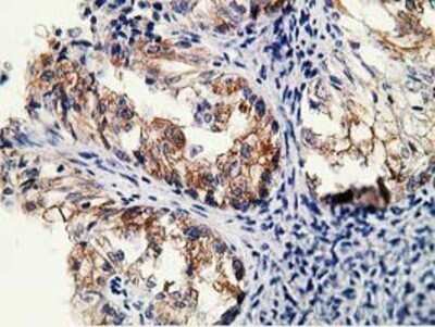 Immunohistochemistry: LNK/SH2B3 Antibody (OTI2D8) - Azide and BSA Free [NBP2-72514]