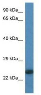 Western Blot: MLC1SA Antibody [NBP1-74247]