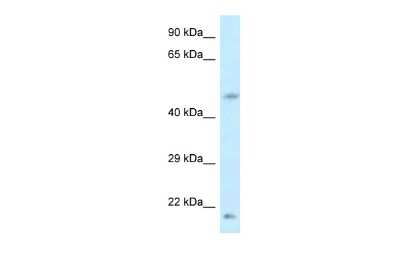 Western Blot: LOC100360413 Antibody [NBP2-84580]