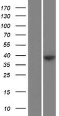 Western Blot: FAM228B Overexpression Lysate [NBP2-09757]