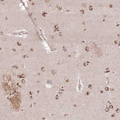 Immunohistochemistry-Paraffin: LOC388813 Antibody [NBP2-14572]