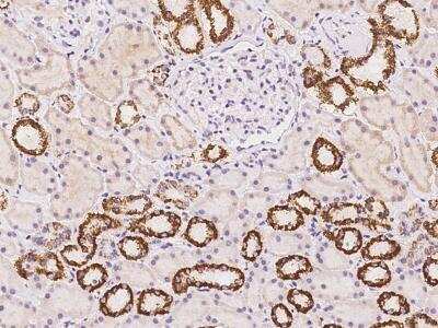 Immunohistochemistry-Paraffin: LOC388813 Antibody [NBP3-06030]