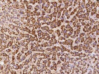 Immunohistochemistry-Paraffin: LOC388813 Antibody [NBP3-06030]