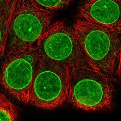 Immunocytochemistry/ Immunofluorescence: REXO5 Antibody [NBP1-92075]