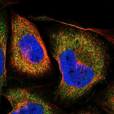 Immunocytochemistry/ Immunofluorescence: LOH12CR1 Antibody [NBP2-30597]