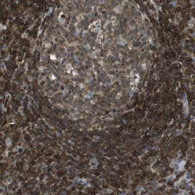 Immunohistochemistry-Paraffin: LOK Antibody [NBP2-13396]