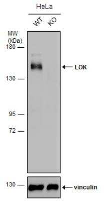 Western Blot: LOK Antibody [NBP2-19368]