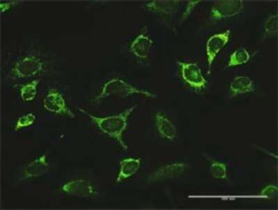 Immunocytochemistry/ Immunofluorescence: LONP1 Antibody [H00009361-D01P]