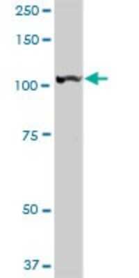Western Blot: LONP1 Antibody [H00009361-D01P]