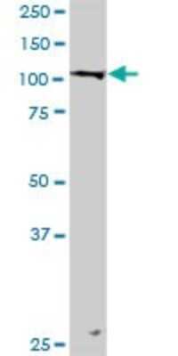 Western Blot: LONP1 Antibody [H00009361-D01P]
