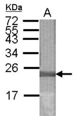 Western Blot: LONP2 Antibody [NBP2-19369]