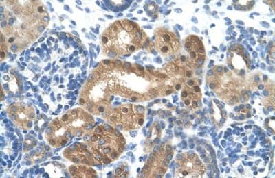 Immunohistochemistry-Paraffin: LONRF1 Antibody [NBP1-55072]