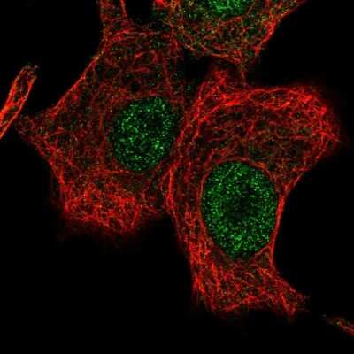 Immunocytochemistry/ Immunofluorescence: LONRF2 Antibody [NBP2-56830]