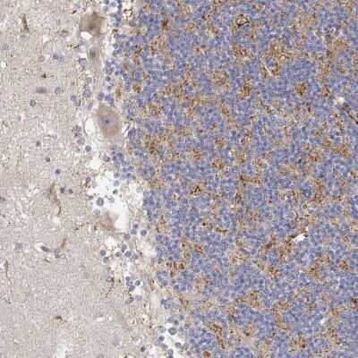Immunocytochemistry/ Immunofluorescence: LONRF3 Antibody [NBP2-68769]